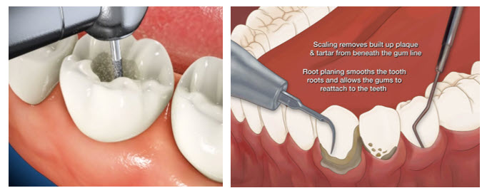 dentists and air quality